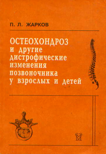 Остеохондроз книги. Жарков остеохондроз и другие. Остеохондроз и другие дистрофические изменения позвоночника. Жарков остеохондроз. Жарков дистрофические изменения.